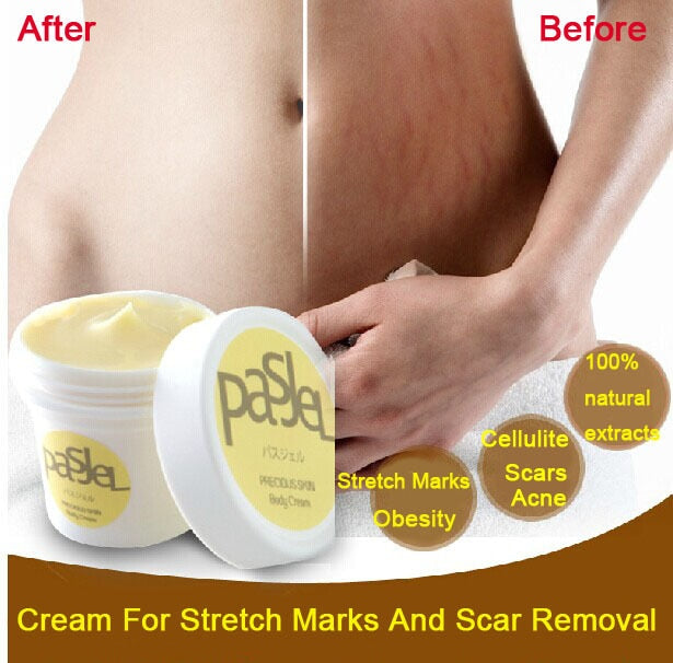 Thailand Pasjel precious Skin Body Cream afy stretch marks remover scar removal powerful postpartum obesity pregnancy cream
