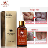 Remedy For Nail Fungus Treatment Feet Care Essence The Herb Toe From Nail Foot Fungal Remove Gel Antifungal Onychomycosis Cream